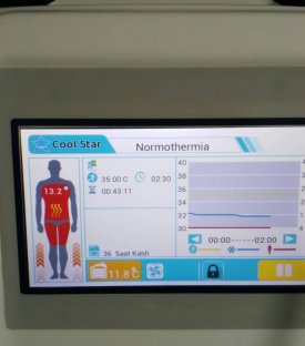HİPOTERMİ CİHAZI
